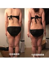 エイジングケアサロン 青山 本店/驚きのビフォア・アフター