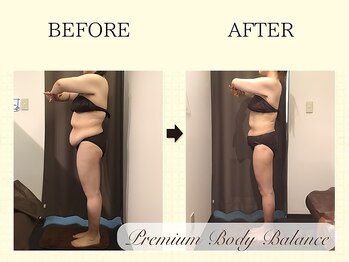 美プレミアム 越谷店/１、施術結果