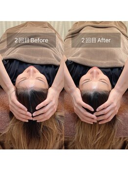 スリージー/before/after