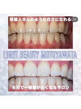 ライトビューティー 本八幡店(LIGHT BEAUTY)/【セルフホワイトニング】