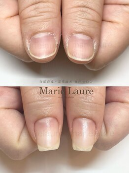 マリーロール 梅田店(Marie Laure)/深爪改善/自爪育成/ネイルケア