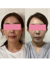 サロンドミジュ(Salon de 美jyu)/小顔・骨格矯正　20代