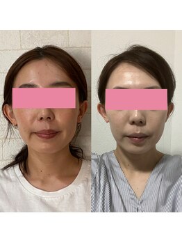 サロンドミジュ(Salon de 美jyu)/小顔・骨格矯正　20代