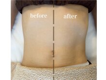 リコット(Licott)/before after写真