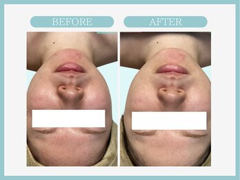 スリムライン 秋田店(The Slim Line)/before→after