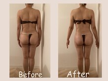 レモン(Lemon)/ビフォーアフター