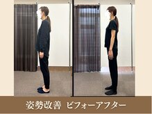 オリエンタル整体院 新潟院/20代 介護職 姿勢改善成果