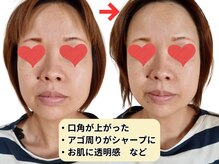 ビエル 掛川店(Bielle)/表情筋フェイシャル75の結果！