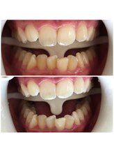 ミラ 中央林間(mira)/小顔　毛穴　ホワイトニング