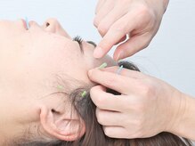 ザワ鍼灸接骨院(zawa鍼灸接骨院)