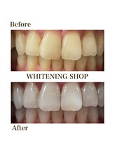 ホワイトニングショップ 四条店/