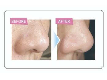 フレッシュ 立川本店(Fre-sh!!)/嬉しい♪たった1回でこの変化!