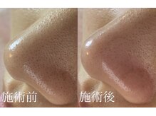 ジェリー(JERRY)/艶々