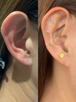 シロ(silo.)/幹細胞導入♪