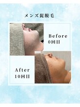 エデン つくば店(EDEN)/メンズ髭脱毛