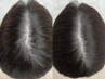 最先端美容【頭皮棘スカルプ】頭皮・毛髪を再生美容で改善！44,000→38,500
