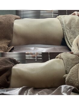 アディ(Adiy)/LINO式腸もみ80分コース