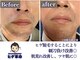 ヒゲ革命 難波日本橋の写真