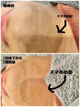 ワイズサロン(Y's salon)/7回終了から2週間後