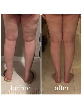 ブリス(BLiSS)/このみ式リンパにプラス♪