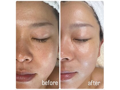 リベレ(Libelle)の写真