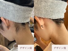 クラームビューティー(Clerm beauty)/美容師によるうなじデザイン脱毛