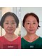 カノン(kanon)の写真/小顔サロンデビュー歓迎！痛みの少ない丁寧な施術で、エラ張り・むくみを解消し理想の小顔へ♪