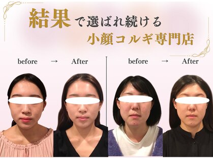 コリアンビューティーサロンリー(Lee)の写真