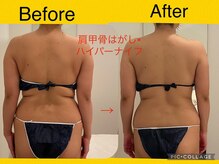 いおり骨盤整体 リブート(RE:BOOT)/ハイパーナイフ×肩甲骨はがし