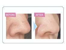 フレッシュ 立川本店(Fre-sh!!)/楽しい♪たった1回でこの変化！