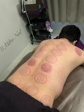 ミカ ネスト(Mika Nest)/自分の体と向き合いましょう♪