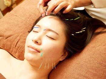ハリキュア(Hari-Cure)の写真/女性鍼灸師による美容鍼＋電気鍼で美肌・小顔・リフトＵＰ！血行を促進し、くすみやむくみ・たるみ改善◎