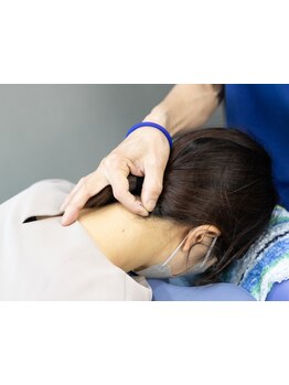 鍼灸施術を受けたい