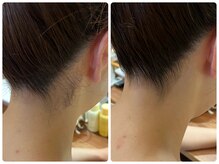 ブリリアント(Brilliant)/花嫁さんうなじシェービング