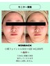 【モニターキャンペーン】小顔フェイシャル50分☆6回コース