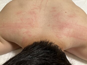 メグムサロン(Megumu Salon)/空ルート/肩こり腰痛/マッサージ