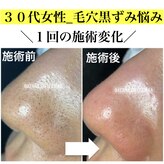 天使の毛穴 岐阜羽島店