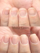 マリーロール 梅田店(Marie Laure)/深爪改善/自爪育成/ネイルケア