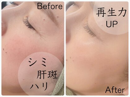 モデラート(moderate)の写真