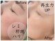 モデラート(moderate)の写真
