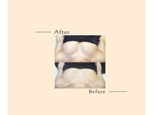 オベリオ(OBERIO)/