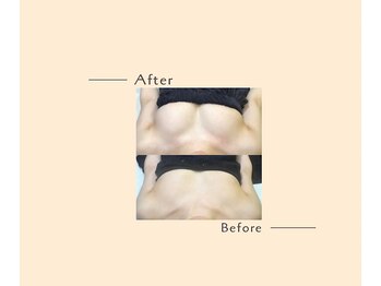 オベリオ(OBERIO)/