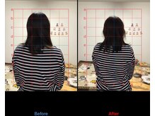 ストレチックス 近江八幡店/肩甲骨周りのコリ、首の痛み撃退