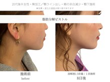 サボラミ(sabor A Mi)/溶解液増量で直近のご予定にも◎