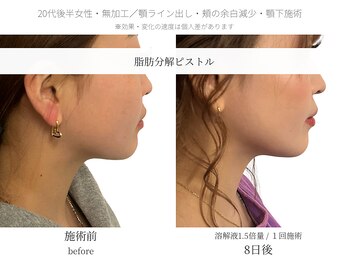 サボラミ(sabor A Mi)/溶解液増量で直近のご予定にも◎