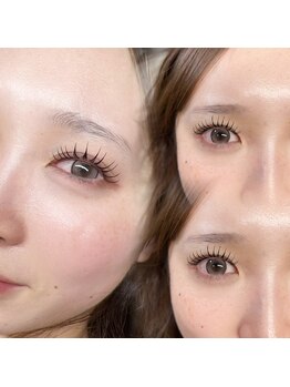 ダーマ(Derma)の写真/&healthyで叶える♪ぱっちり垢抜けまつ毛