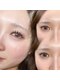 ダーマ(Derma)の写真/&healthyで叶える♪ぱっちり垢抜けまつ毛