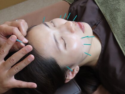 いしはら鍼灸接骨院 用賀の写真