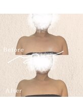 ブリリアントライフ(Blilyant life)/夏に向けて筋膜リリース