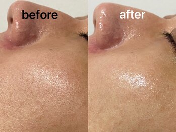 ユイット ルッカ(Huit Lucca)/ララピール